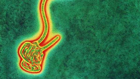 Ebola virus (Credit: SPL)