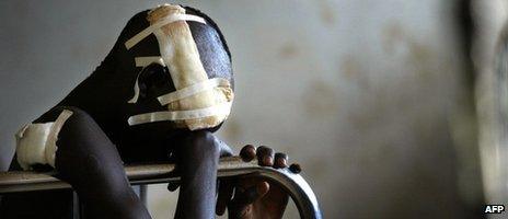 A boy wounded during an attack by rebels in northern Uganda sits in hospital (November 2003)