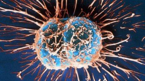 Cervical cancer cells dividing