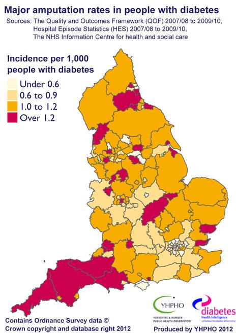 Regional breakdown of major amputations