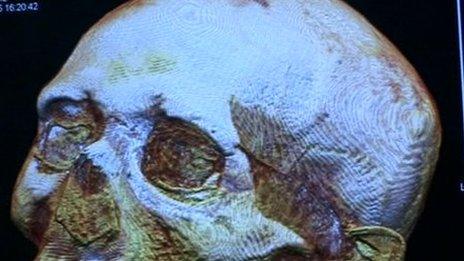 CT scan of Iset Tayef Nakht's skull