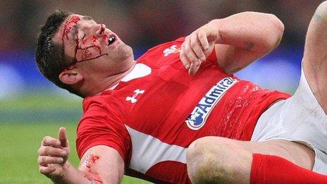 Huw Bennett