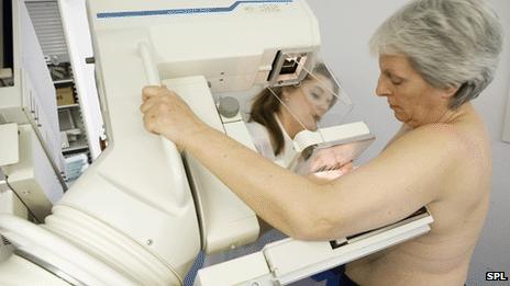 Breast cancer screening