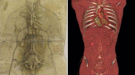 Da Vinci sketch of a torso and a CT image of one