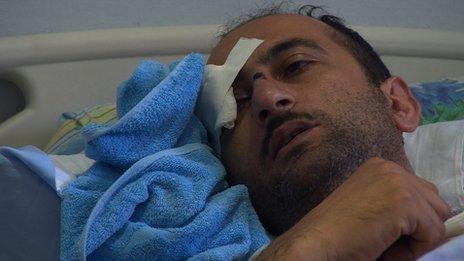 Idrak Abbasov lying in hospital bed with one eye covered by a dressing