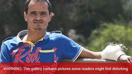 Injured Yemeni man, Imad