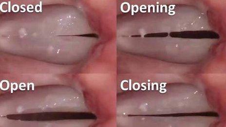 Vocal folds in action, credit James P.Thomas