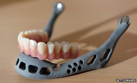 Artificial jaw made in a 3D printer in Germany