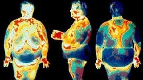 Thermogram of obese people