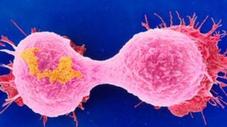 breast cancer cells