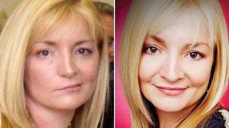 Debbie Johnston - whilst suffering from Bell's palsy, and having recovered