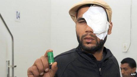 A Tunisian man shows a cartridge after he was injured during clashes with police in the town of Siliana on 28 November 2012