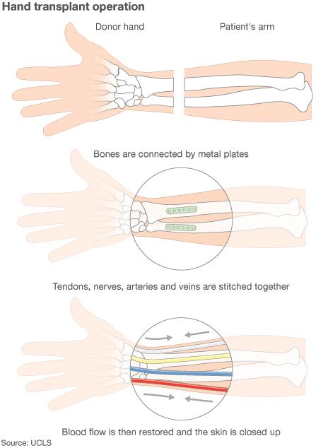 Graphic explaining the operation