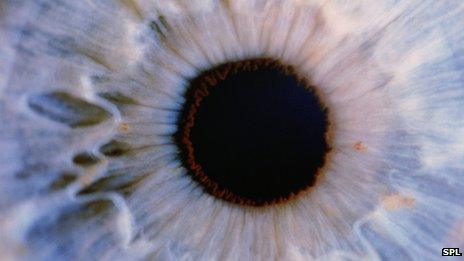 Eye