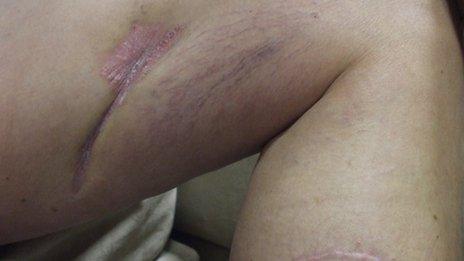 Paul Conroy's left leg