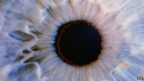 Eye