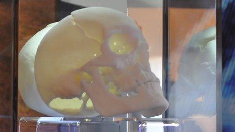 A 3D replica of the skull