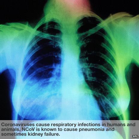 Coronaviruses cause respiratory infections in humans and animals. NCoV is known to cause pneumonia and sometimes kidney failure.