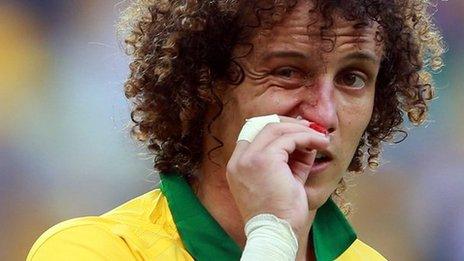 Chelsea and Brazil David Luiz broken nose