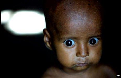 9-month-old Salma stares blankly from the doorway of her home on the Yamuna River in New Delhi Friday Aug. 17, 2001.