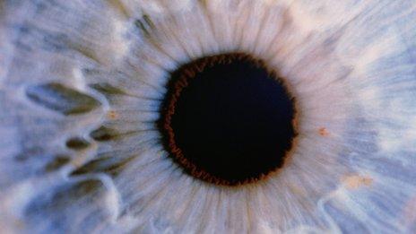 Eye