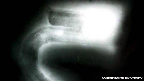 X-ray of iron hook