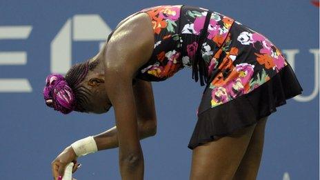 Venus Williams