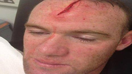 Wayne Rooney