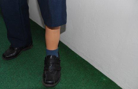 Arno Sonntag's artificial left leg