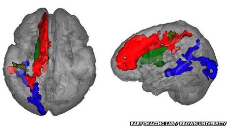 Regions of the brain that show leftward asymmetry of myelin