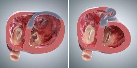 Before and after surgery