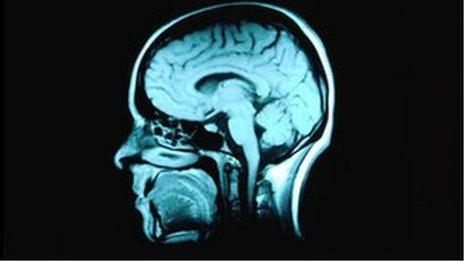 MRI scan