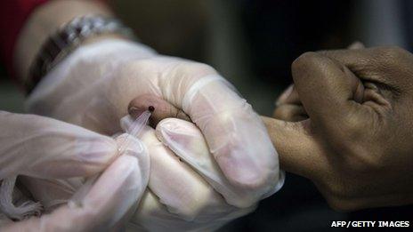 An HIV test being given