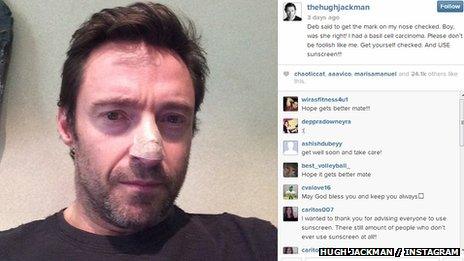 Hugh Jackman on Instagram