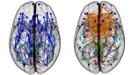 brain networks