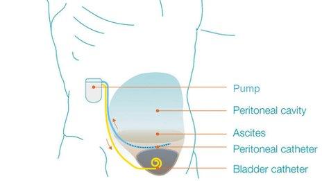 pump diagram