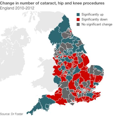 Map showing the change in the number of cataract, hip and knee procedure between 2010 and 2012