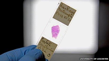 Slide containing tissue sample from Alfred Rouse's victim