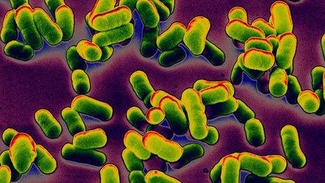 Clusters of the bacteria that cause bubonic plague