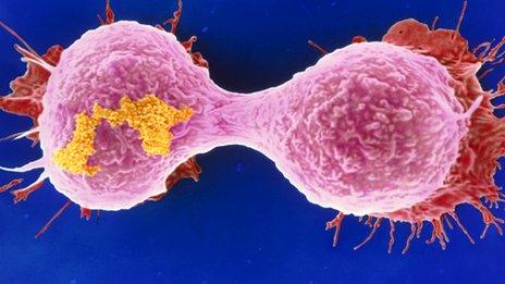 Dividing breast cancer cell