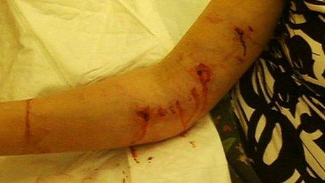 Injuries to Dawn Priestley's arm