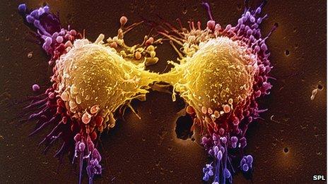 Prostate cancer cells dividing