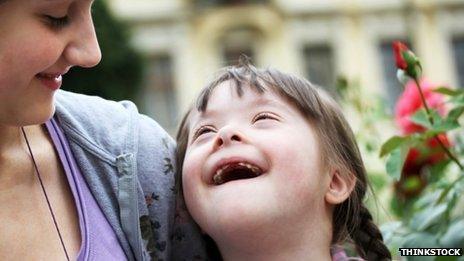 Girl with Downs syndrome