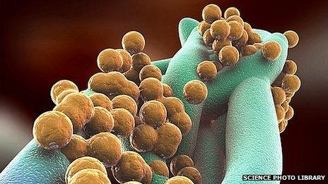 Artist's impression of Staphylococcus aureus MRSA