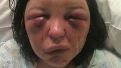 Domestic abuse victim