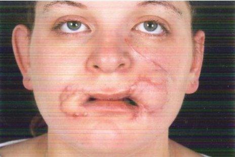 Laura Holmes after the attack