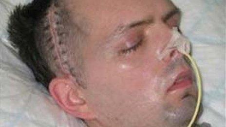 Derry civil servant Paul McCauley after he was beaten up in a sectarian attack in July 2006