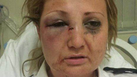 Nicola Williams with cuts and bruises on her face