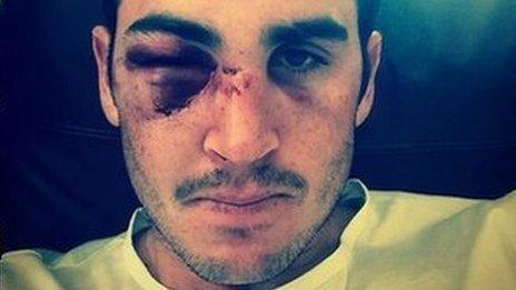 Craig Kieswetter tweeted a picture of his injuries in July