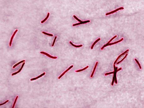 Mycobacterium tuberculosis